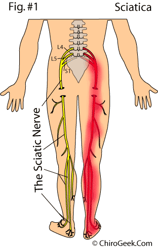  Lower back pain right side